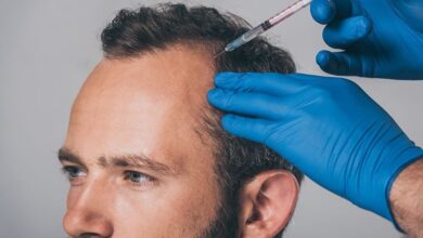 PRP hair treatment cost in India