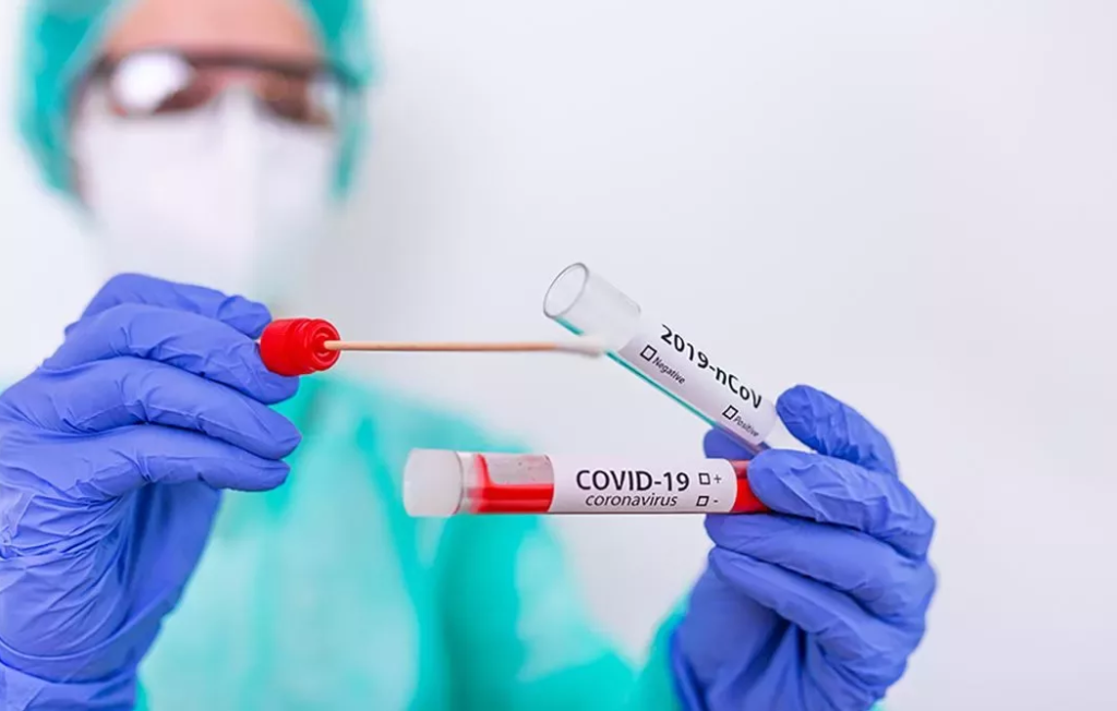 RT PCR test covid 19