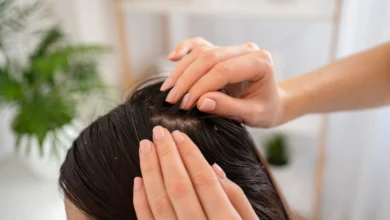 How can you eliminate the problem of dandruff from your life naturally?
